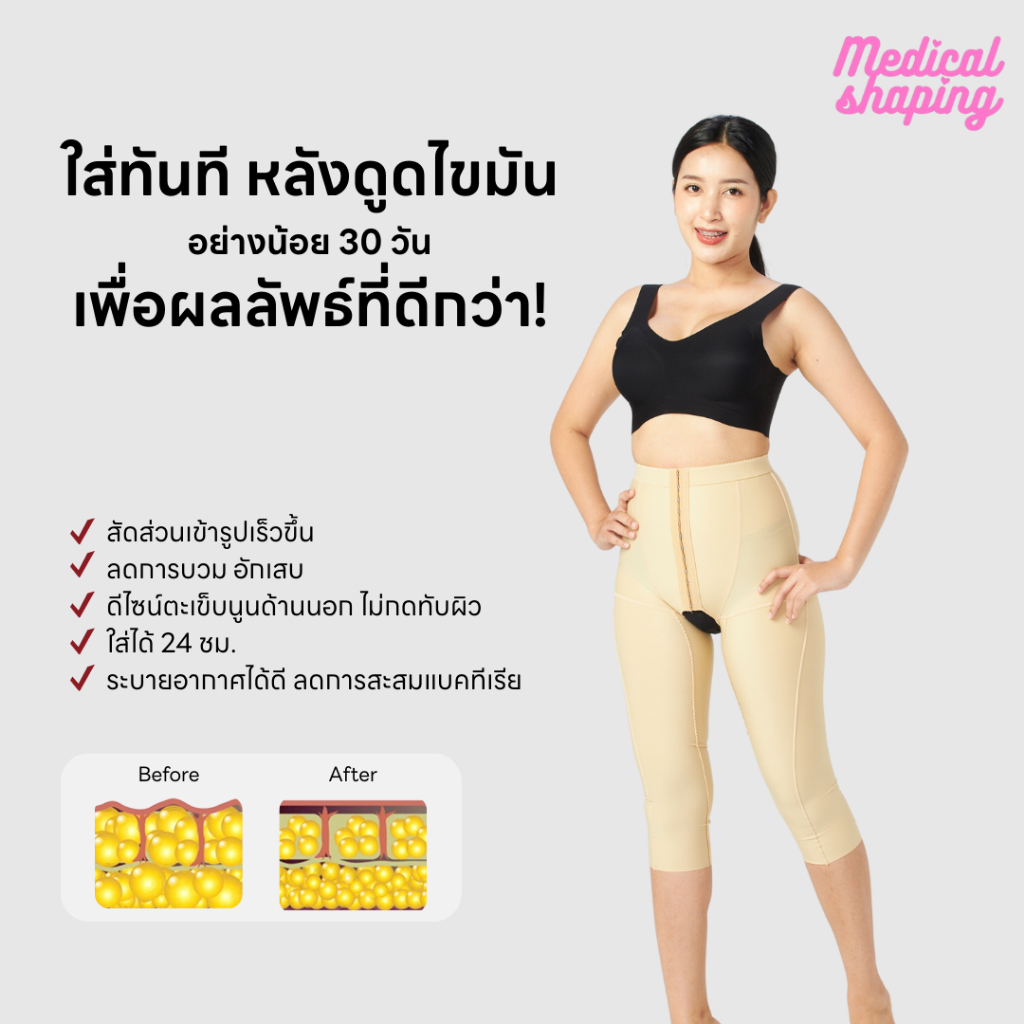 Medical shaping ชุดกระชับหลังดูดไขมัน ต้นขา คลุมเข่า เปิดเป้า ดูดไขมัน กางเกงหลังดูดไขมัน เกรดทางการแพทย์ ราคา ถูกที่สุด ดีลบีเคเค แกลเลอรีภาพที่ 4