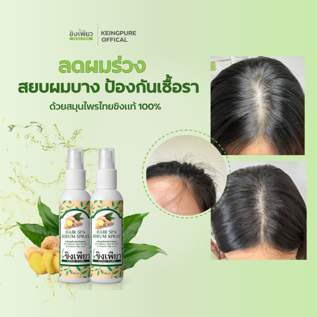 ขิงเพียวเซรั่มสเปรย์สมุนไพรลดผมร่วงปลูกผม1แถม1 MADE IN THAILAND
