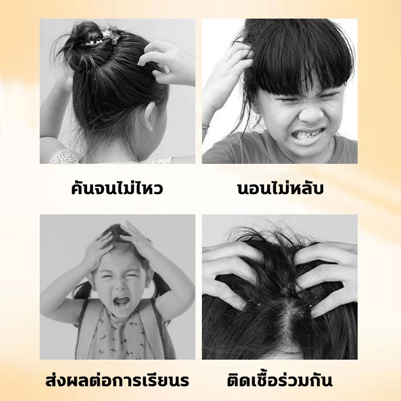 กำจัดเหาและไข่เหา2in1 ยาฆ่าเหา ลดคันลดรังแค อ่อนโยนไม่ทำร้ายผิว แชมพูกำจัดเหา กำจัดเหาและไข่ แก้คัน กลิ่นหอม แชมพูฆ่าเหา - รูปที่ 2