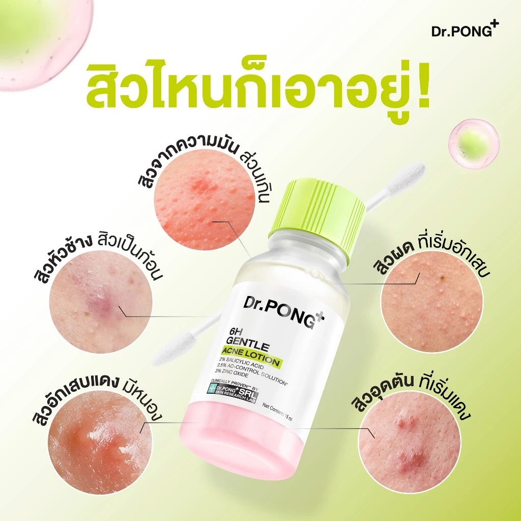 Dr.PONG 6H GENTLE ACNE LOTION แป้งน้ำแต้มสิว สิวยุบใน 1 คืน แห้งไว ไม่ทิ้งรอย ไม่ขึ้บนซ้ำ thumbnail 4