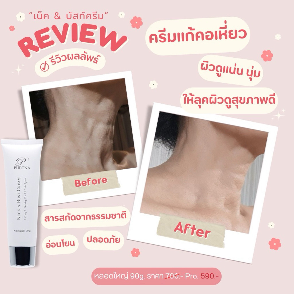 ฟีโอน่า ครีมนวดลำคอ และหน้าอก BUST & NECK CREAM
