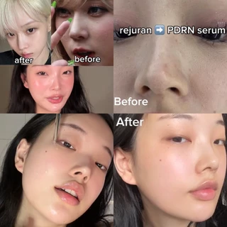 รวมเซรั่ม Azelaic Acid 10 Hyaluron/ PDRN Hyaluronic Acid Capsule 100/ Niacinamide 10% + TXA 4%