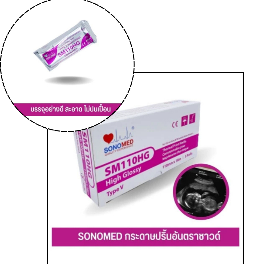 SKYMED Thermal paper for Ultrasound (ultrasound printer paper)