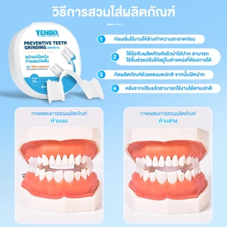 ฟันยาง ฟันยางซิลิโคน ยางครอบฟัน ยางกัดฟัน พร้อมกล่อง ยางครอบฟันแก้อาการนอนกัดฟัน