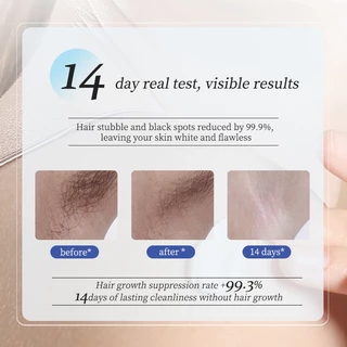 VIVX ครีมกำจัดขน มูสกําจัดขน ครีมกำจัดขนรักแร้ 100g กำจัดขนที่ลับ ตั้งครรภ์ก็ใช้ได้ ไม่เหลือตอ อ่อนโยนไม่ระคายเคือง