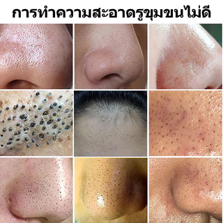มาส์กกำจัดสิวหัวดำ มาส์กจมูกสิวหัวดำ มาร์คโคลน 60g ลอกสิวหัวดำ ลอกสิวเสี้ยน รูขุมขนสะอาด กระชับรูขุมขน ผิวแพ้ง่ายใช้ได้