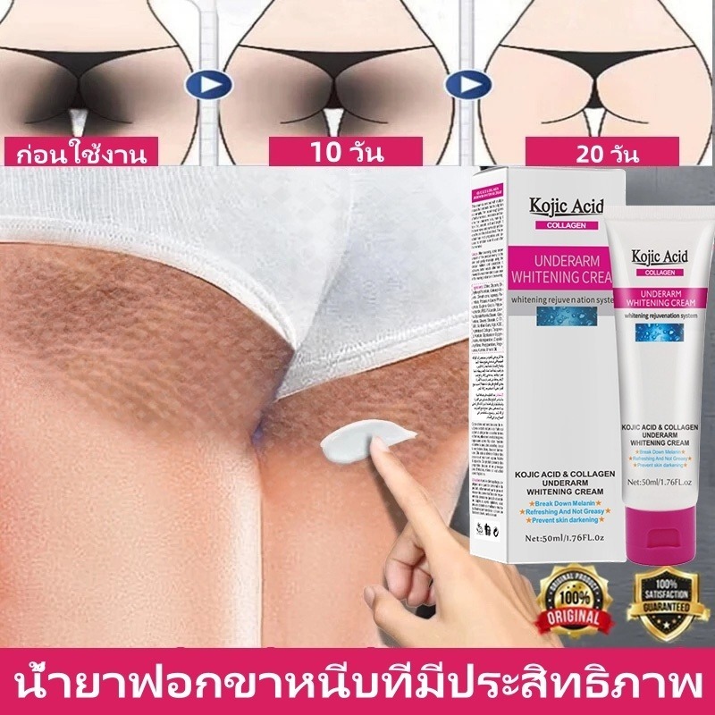 💓จัดส่งด่วน💓Kojic Acid ครีมขาวจุดซ่อนเร้น ครีมไวท์เทนนิ่งรักแร้ ช่วยลดเมลานิน เหมาะสำหรับรักแร้ ข้อศ