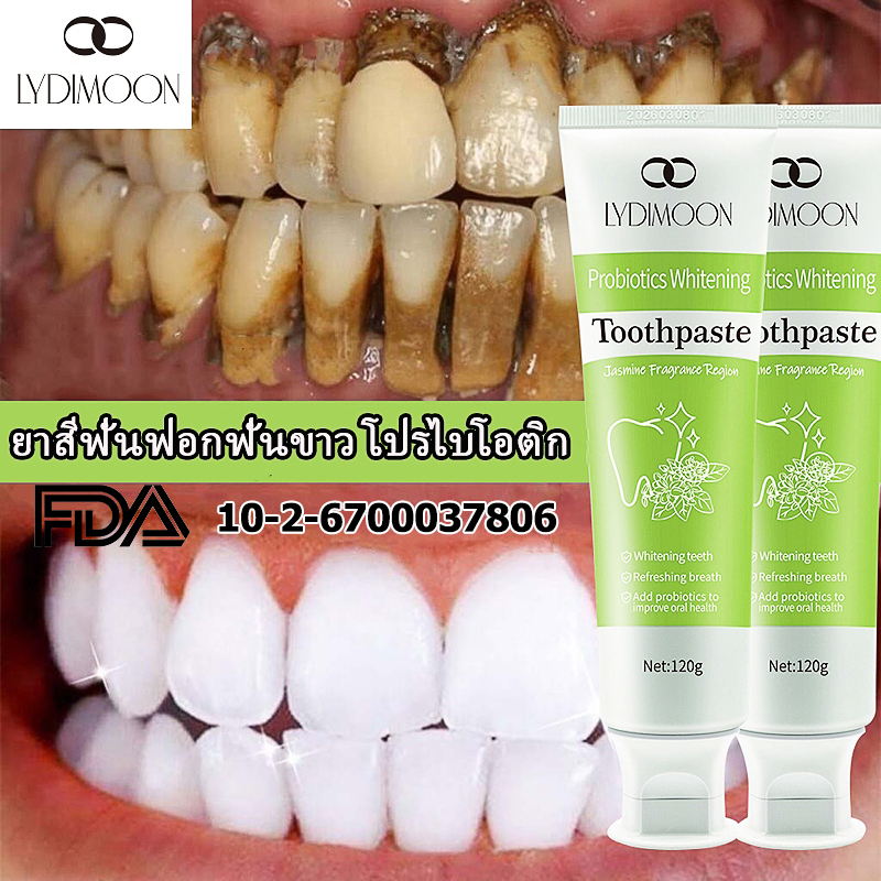 ยาสีฟันไวท์เทนนิ่ง ยาสีฟันฟันขาว ยาสีฟันฟอกฟันขาว 120ml ฟอกสีฟัน ขจัดคราบหินปูนคราบฟัน ขจัดคราบพลัค ลดกลิ่นปาก ขายดีในTK