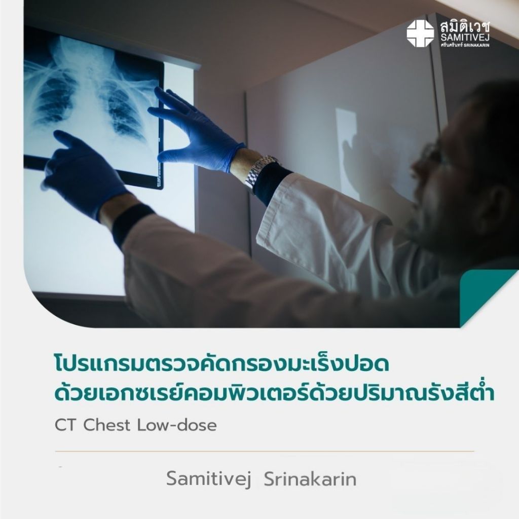 [E-Coupon] ตรวจคัดกรองมะเร็งปอดด้วย Ultra Low Dose CT Chest with AI รังสีน้อยลง 80–90%  สแกนเจอแม้จุดเล็ก 2 มม.