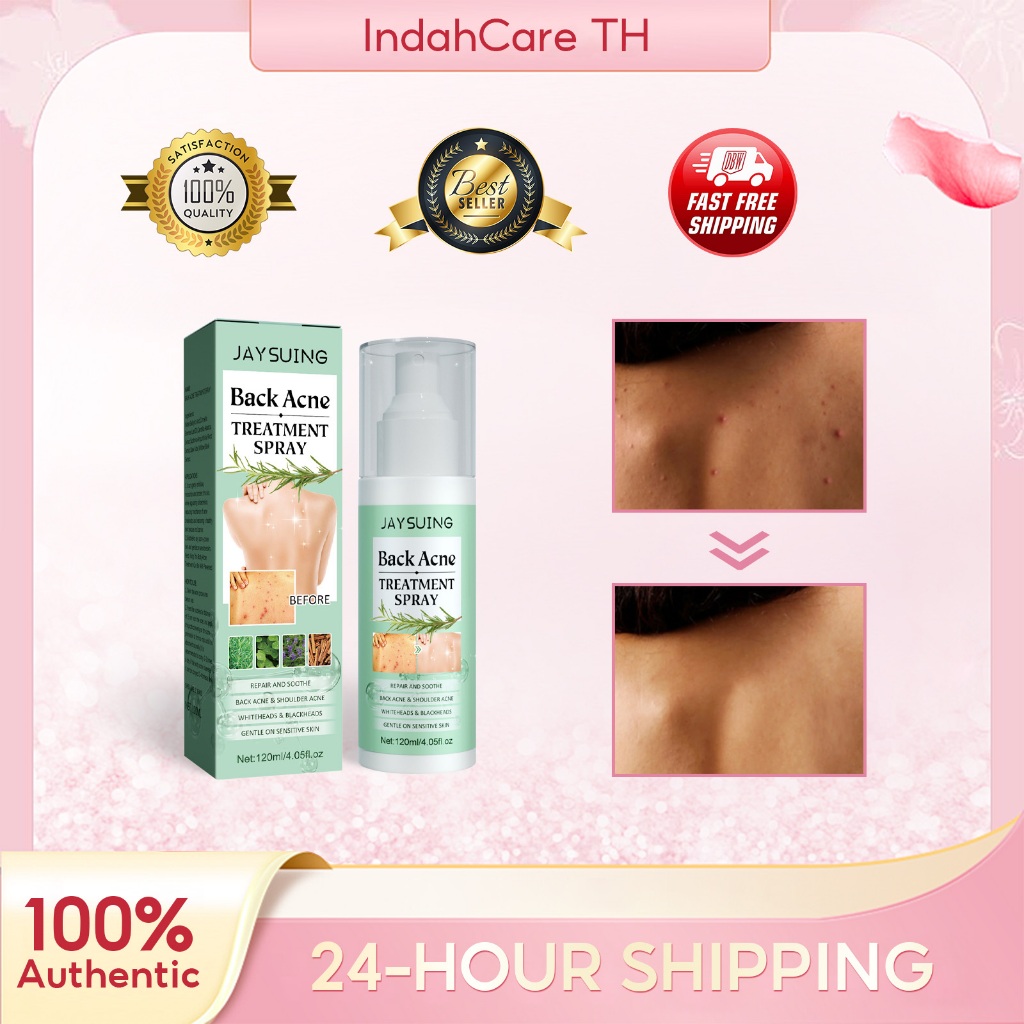 Jaysuing สเปรย์สำหรับสิวที่หลังและลำตัว ลดสิวและสิวเสี้ยนบนร่างกาย ครีมแต้มสิวที่หลังและลำตัว 120ml