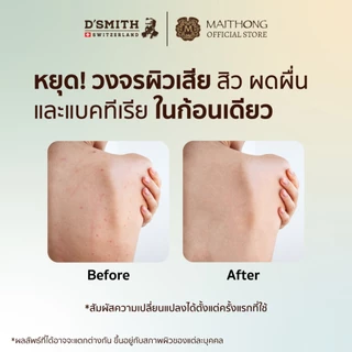 [เซ็ตสุดคุ้ม แพ็ค3] D'SMITH ดีสมิทธ์ สบู่สมุนไพรจากสวิตเซอร์แลนด์ 100g สบู่ลดสิว ผดผื่นคัน ระงับกลิ่นกาย สูตรอ่อนโยน สำ