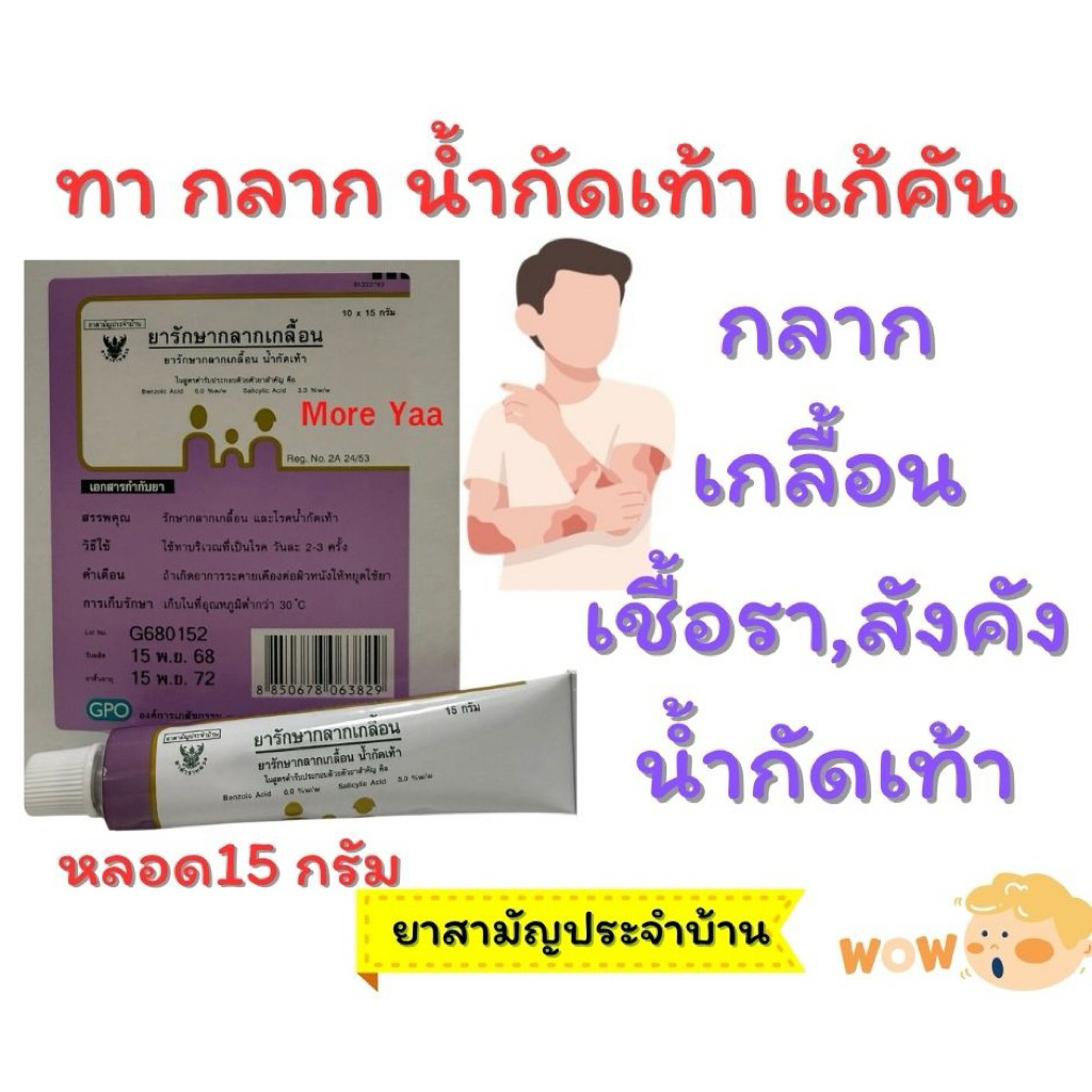 ครีมทากลาก เกลื้อน เชื้อรา น้ำกัดเท้า
