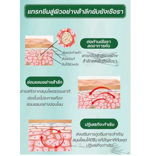 ครีมแก้คันผิว ลดผื่นคัน บรรเทาอาการคัน ฆ่าเชื้อรา ฟื้นฟูผิว เห็นผลไว 20G