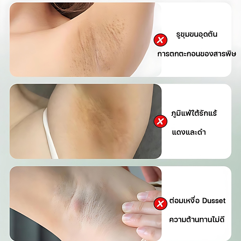 สดชื่นและมั่นใจ ระงับเหงื่อโรลออนกำจัดกลิ่นไม่มีผลข้างเคียง แท่งต้านเหงื่อ ขจัดเหงื่อและทิ้งกลิ่นหอม ราคา ถูกที่สุด ดีลบีเคเค แกลเลอรีภาพที่ 6