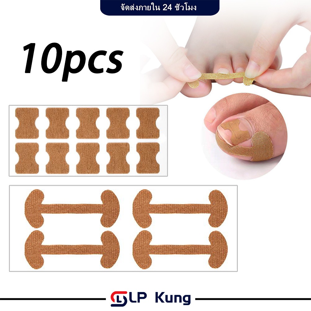 แพ็คละ 10 ชุด แผ่นแปะเล็บขบ เล็บเท้า แผ่นติดเล็บขบ รักษาเล็บขบ สติ๊กเกอร์เล็บขบ ปรับเล็บขบ แก้ไขโรคพาโรนีเชีย