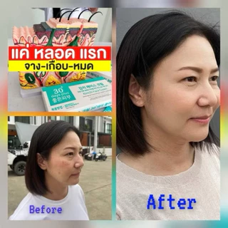⚡️พร้อมส่ง⚡️ครีมกิมจิ 🥬 ของแท้มีบัตรตัวแทน✅ เคลียร์ฝ้า บำรุงผิวหน้า ไม่ทำให้หน้าบาง