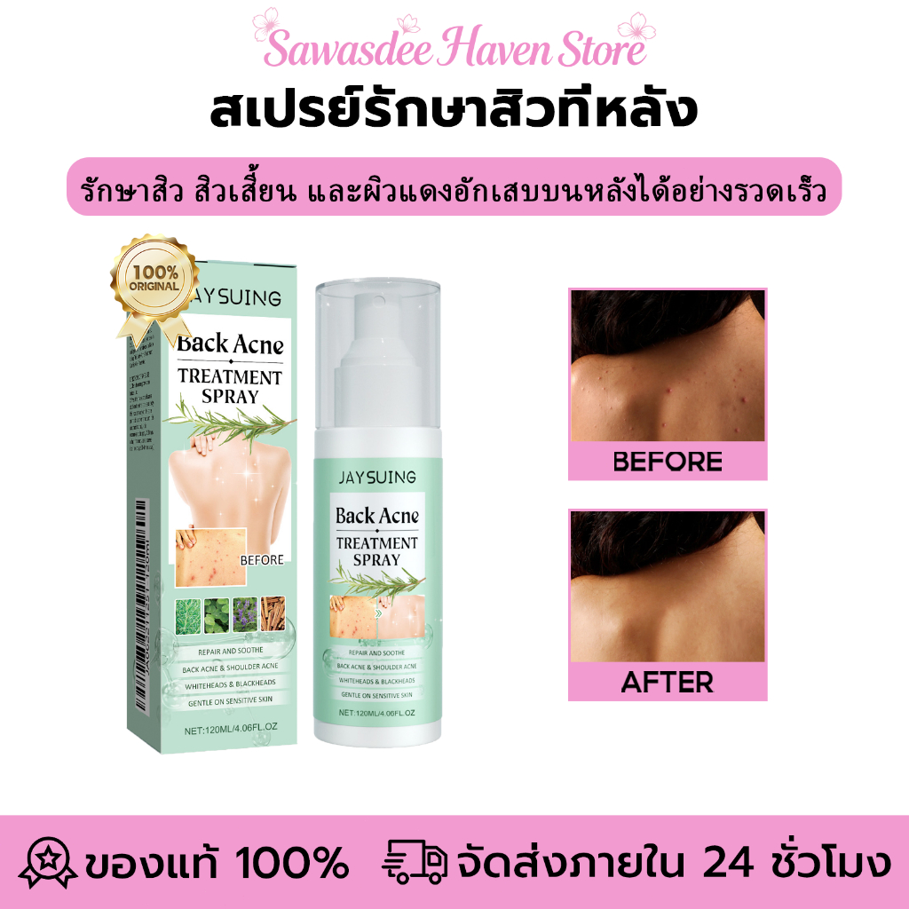 Jaysuing สเปรย์รักษาสิวที่หลัง รักษาสิว สิวเสี้ยน และผิวแดงอักเสบบนหลังได้อย่างรวดเร็ว สเปรย์บำรุงหลัง