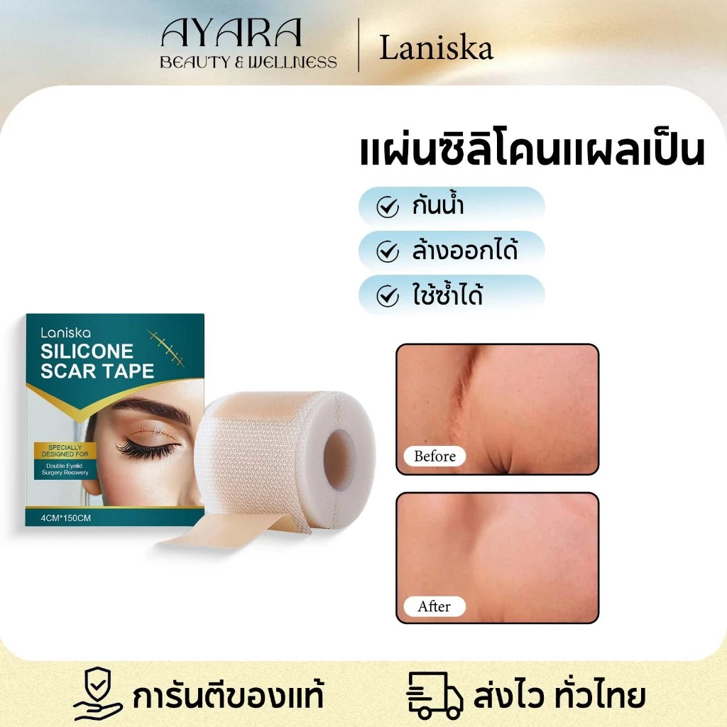 Laniska ซิลิโคนแปะแผลเป็น แผ่นแปะลดรอยแผลเป็น แผ่นแปะแผลเป็น รักษารอยแผลเป็น แผลผ่าตัด แปะแผลผ่าคลอด
