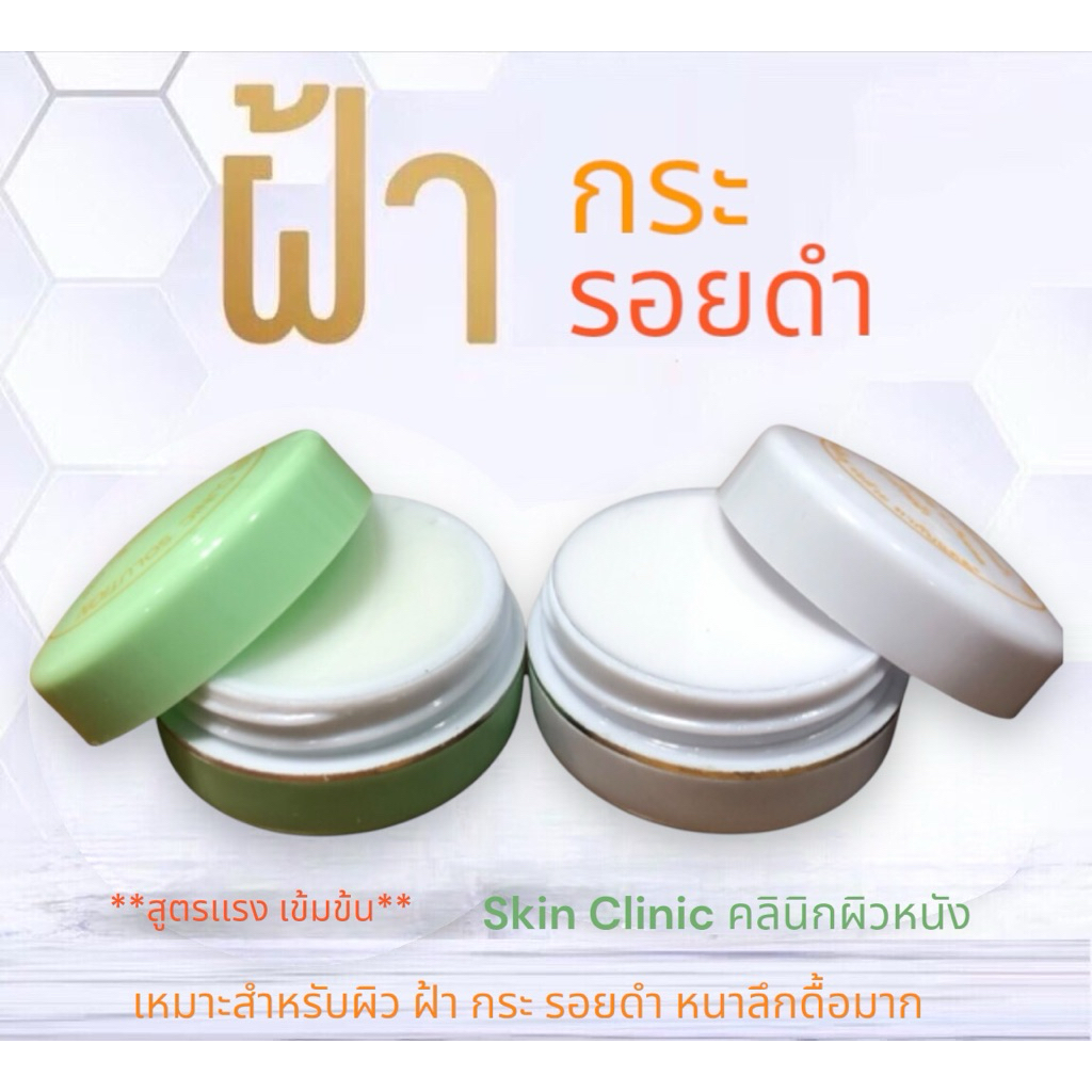 1 เเถม 1 ครีมฝ้าตลับเขียว แถม ตลับvาว สูตรแรง ฝ้า กระ ดื้อหนาลึก Skin Clinic ครีมคลินิกผิวหนังโดยตรง