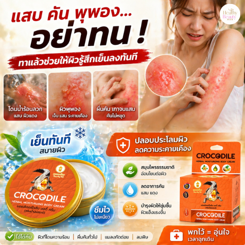 ครีมจระเข้ ทองทรงไทย 30g แก้คัน ผดผื่น ลมพิษ น้ำร้อนลวก ผิวพุพอง ลดแสบแดง สมุนไพร
