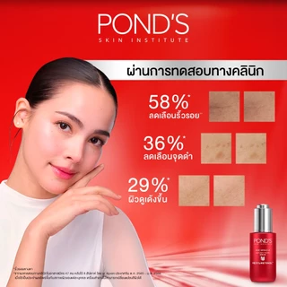 พอนด์ส เอจ มิราเคิล เซรั่มหน้าเด็ก สูตรกลางวันและกลางคืน ลดริ้วรอยใน 3 วัน ผิวเด้งฟูดูนอนเต็มอิ่ม เฮ็กซิล-เรตินอล 30 ก.