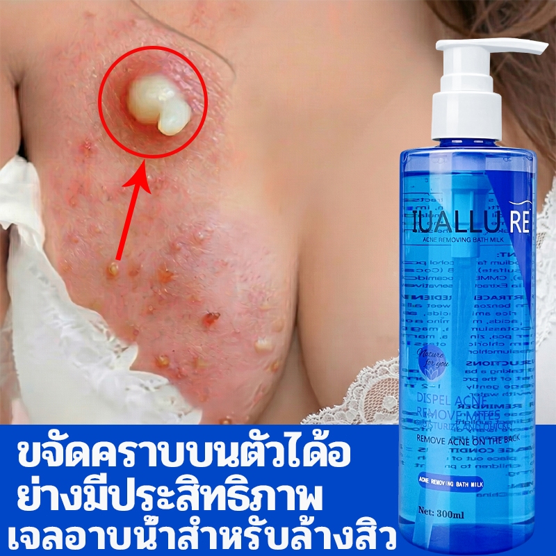body wash ครีมอาบน้ำ ครีมอาบน้ำลดสิว 300ml ต่อต้านเชื้อราแก้คัน ให้ความชุ่มชื้นอ่อนโยน กลิ่นหอมติดทน ลดสิว กำจัดไร คุมน้