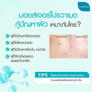 PROVAMED ACNICLEAR BIO-PEPTIDE ANTI ACNE MOISTURIZER 40 ML - โปรวาเมด มอยส์เจอไรเซอร์ ไบโอเปปไทด์