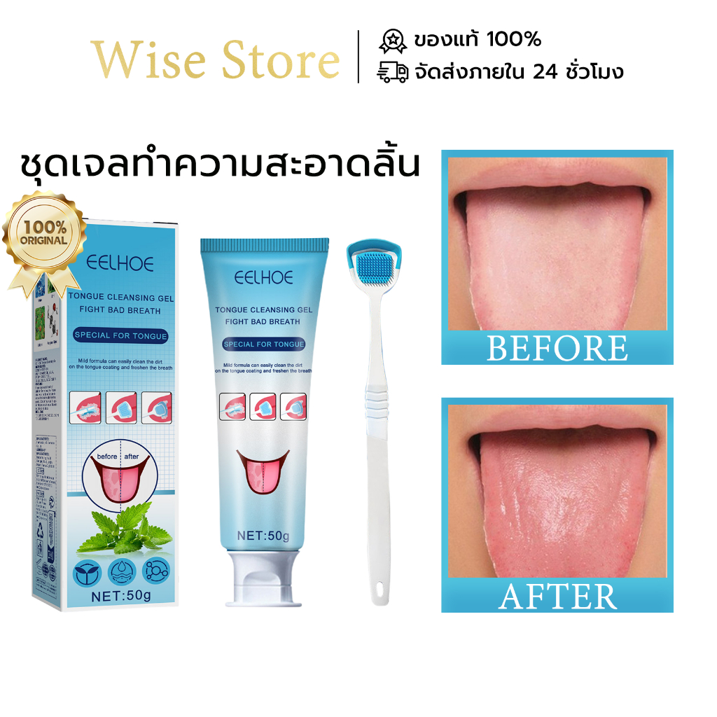 EELHOE เจลทําความสะอาดลิ้น+ที่แปรงลิ้น ที่ทําความสะอาดลิ้น ลดกลิ่นปาก ลดแบคทีเรียในช่องปาก ลมหายใจสดชื่น ดูแลช่องปาก ราคา ถูกที่สุด ดีลบีเคเค