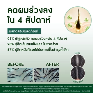 [สินค้าขายดี] [แพ็คคู่] อีฟโรเช Yves Rocher Anti-Hair Loss แชมพูและครีมนวดลดผมร่วง - ลดผมร่วง ผมบาง บำรุงเส้นผม