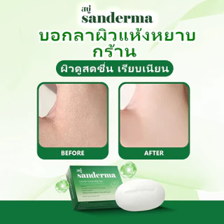 Sanderma สบู่แก้คัน 50 กรัม สบู่สมุนไพรลดอาการคัน ผื่นภูมิแพ้ผิวหนัง กลากเกลื้อน และสะเก็ดเงิน