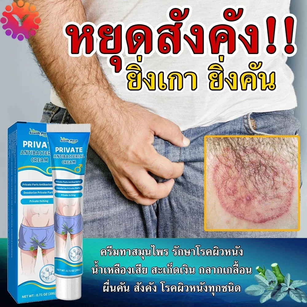 🔥ครีมลดอาการคัน 20g ทาแก้คัน สารสกัดจากพืชใช้ได้ กลากเกลื้อน เชื้อรา ผลิตจากธรรมชาติ ใช้ทาผิวหนังทุกชนิด