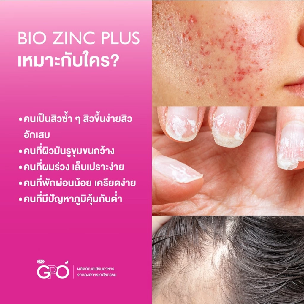 [1แถม1] GPO PLUS BIO ZINC PLUS | ไบโอ ซิงค์ ผิวแข็งแรง ดูแลปัญหาสิว แก้ผิวโทรม โดย GPO Plus องค์การเภสัชกรรม thumbnail 6