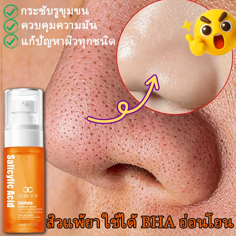 เซรั่มกรดซาลิไซลิก เซรั่มลดสิว 35 ml ช่วยกระชับรูขุมขน ควบคุมการหลั่งไขมัน ให้ความชุ่มชื้น และขัดเซลล์ผิวที่ตายแล้ว