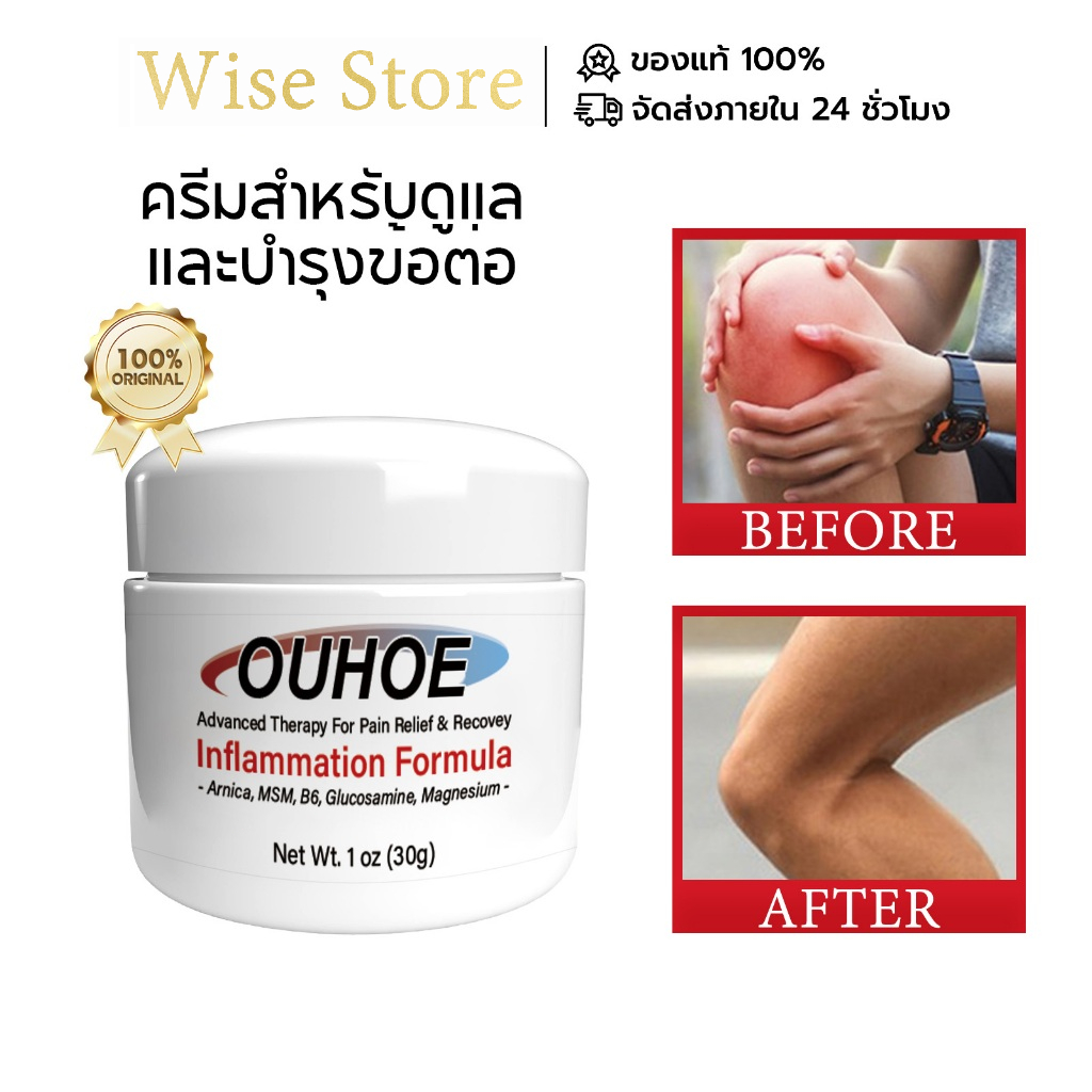 OUHOE ครีมบำรุงข้อต่อ ผ่อนคลายกล้ามเนื้อ บรรเทาความเมื่อยล้าของกล้ามเนื้อ บรรเทาอาการไม่สบายร่วม การดูแลข้อต่อ