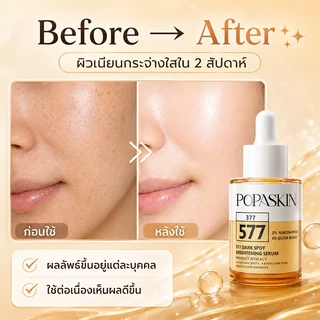 POPASKIN 577+377 Dark Spots Brightening Serum เซรั่มผิวกระจ่างใส ลดเลือนจุดด่างดำ รอยสิว ดูแลผิวหมองคล้ำ ผิวแพ้ง่าย 30ML
