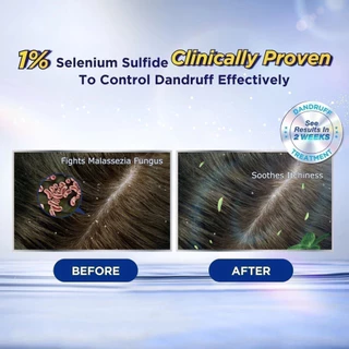 🧴แชมพู Selsun Blue Pro X ฝาแดง สูตร Extra Strength ขจัดรังแคหนัก 120 ml. ลดคันหนังศีรษะ ควบคุมความมันได้ดี