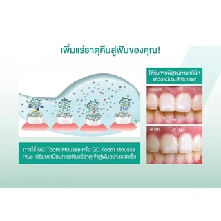 🔥 GC Tooth Mousse 40g อย.ไทย แท้100% ( ทูธ มูส กลิ่นสตอเบอรี่ ) สกัดมาจากโปรตีนในน้ำนมวัว