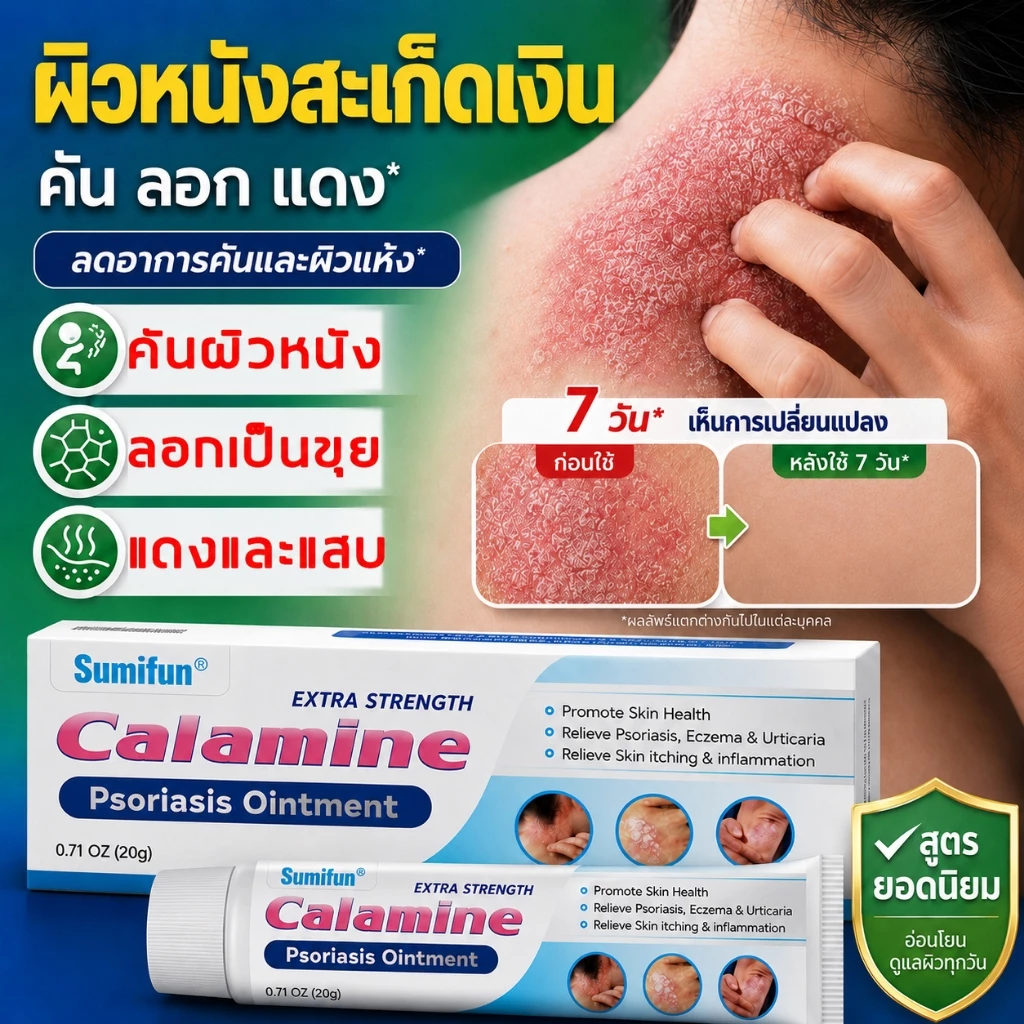 🔥[หายคันไว]🔥ครีมแก้คัน ช่วยดูแลปัญหาผิวจากเชื้อรา เช่น เชื้อราที่มือ เท้า และลำตัว ช่วยลดอาการลอกและผิวแดง