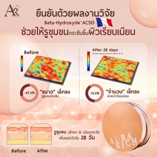 คุชชั่นออร่าริช คุชชั่นอิงฟ้า ขนาด 15g. ของแท้ (Aura Rich Cushion SPF50PA++++) ปกปิดเรียบเนียน เป็นสิวใช้ได้[มีของแถม❗]