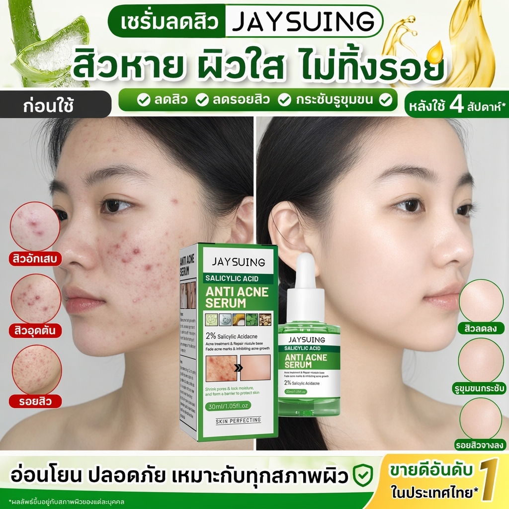 ครีมแต้มรักษาสิว 30ml เซรั่มลดสิว เจลกำจัดสิว ช่วยรอยสิวจางลงเร็ว