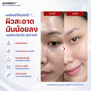 ชาร์โคโลจีโคลนล้างหน้าถ่านไม้ไผ่ คุมมัน ลดสิว Charcoalogy Anti-Shine Pore Purifying Clay Cleanser
