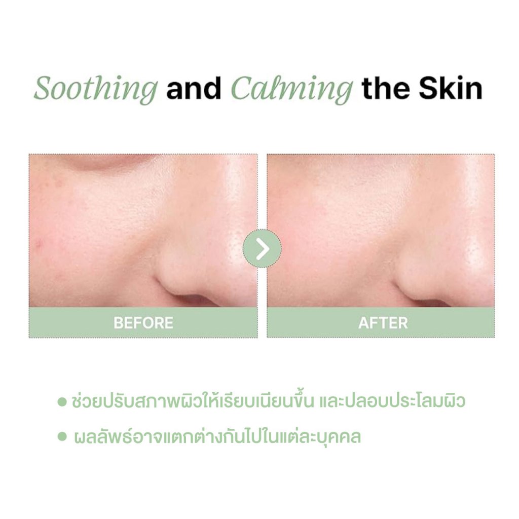 [SET 2 PCS.] NOWATER PRESTIGE73 TEA TREE MASK 70g. | โนวอเทอร์ เพรสทีจ73 ทีทรี มาสก์ 70 กรัม — صورة 5