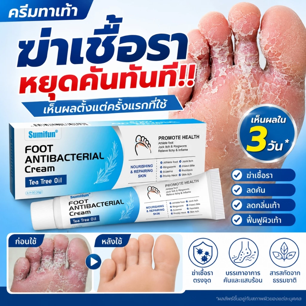 【ลดคัน เชื้อราที่เท้า 】ครีมรักษาเชื้อราเท้า ช่วยลดคันและความอับชื้น ดูแลผิวเท้าให้แห้งสบาย ซึมไว ใช้ง่าย