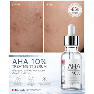 DERMADIC เดิมมาดิก AHA เอเอชเอ ทรีทเมนท์ ซีรั่ม 30 ml. บำรุงผิว ช่วยบำรุงแม้ผิวที่บอบบางแพ้ง่าย ลดเลือนรอยแดงและรอยดำ