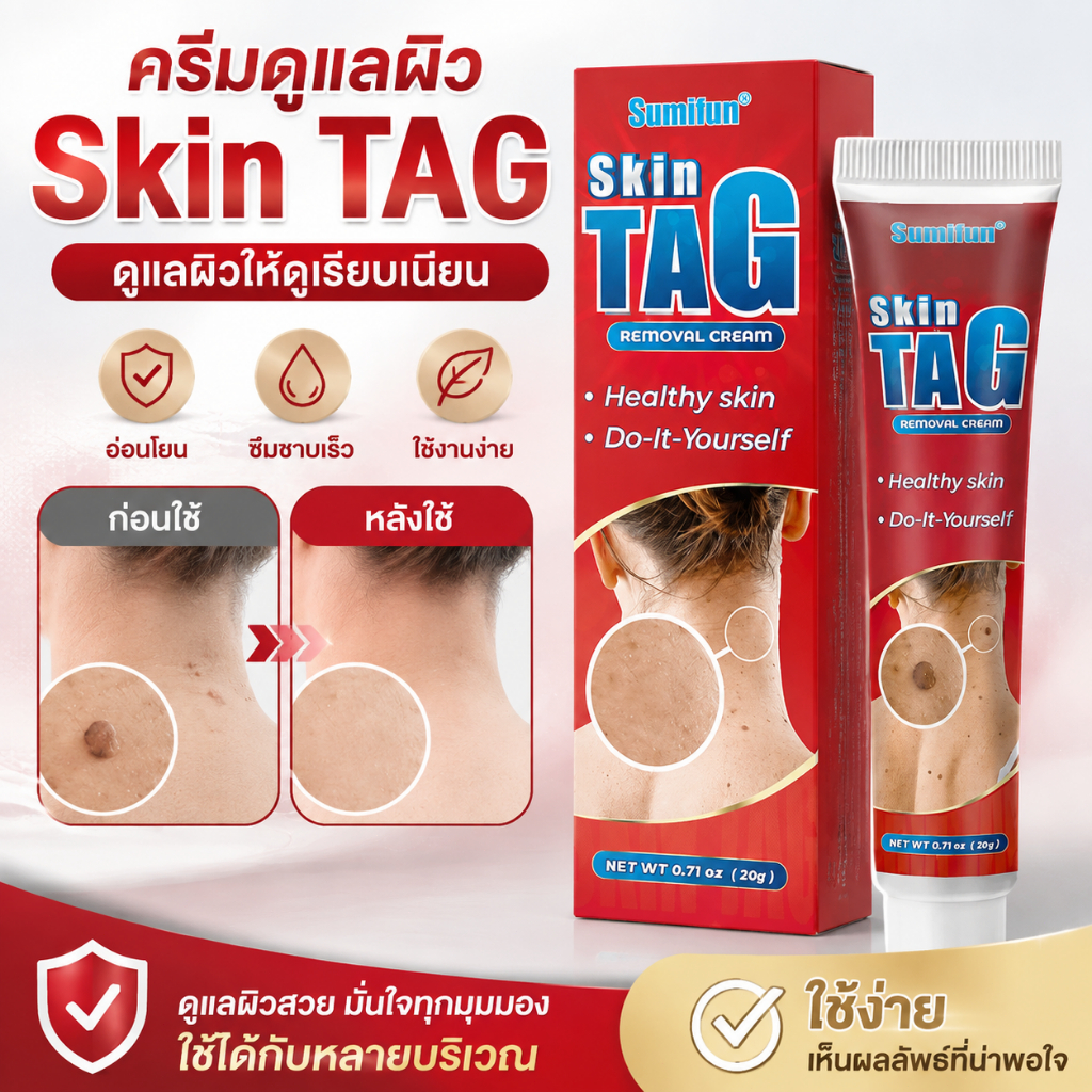 Skin Tag Cream ครีมดูแลผิว Skin Tag ครีมบำรุงผิวกาย เนื้อครีมบางเบา ซึมง่าย ดูแลผิวให้ดูเรียบเนียน ใช้ได้ทุกวัน