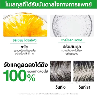Vichy วิชี่ แชมพู ขจัดรังแค(ขวดใหญ่ 390ml.) VICHY DERCOS ANTI DANDRUFF SHAMPOO ขจัดปัญหารังแคและลดความคัน