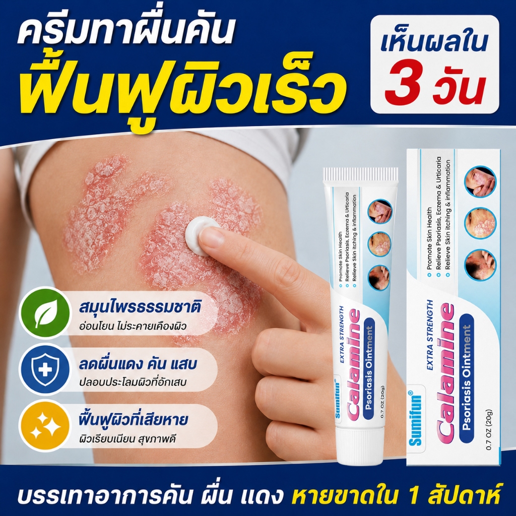 1 ครั้งเห็นผล ครีมลดอาการคัน สะเก็ดเงินครีม โรคผิวหนัง เกลื้อน กลาก คัน คันในร่มผ้า