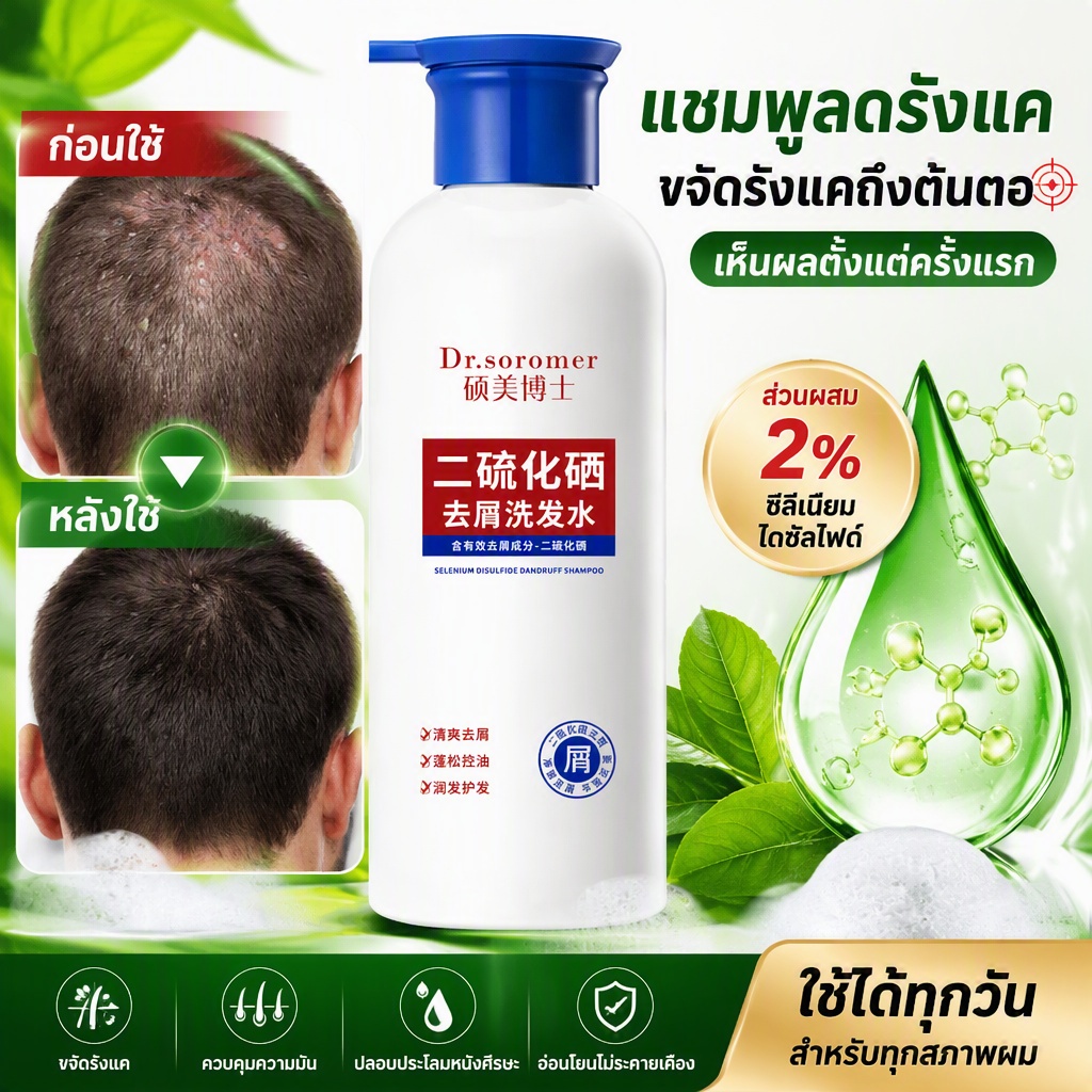 แชมพูดูแลหนังศีรษะ ซีลีเนียมไดซัลไฟด์ 400ml ผมนุ่มฟู ใช้ได้ทั้งชายหญิง