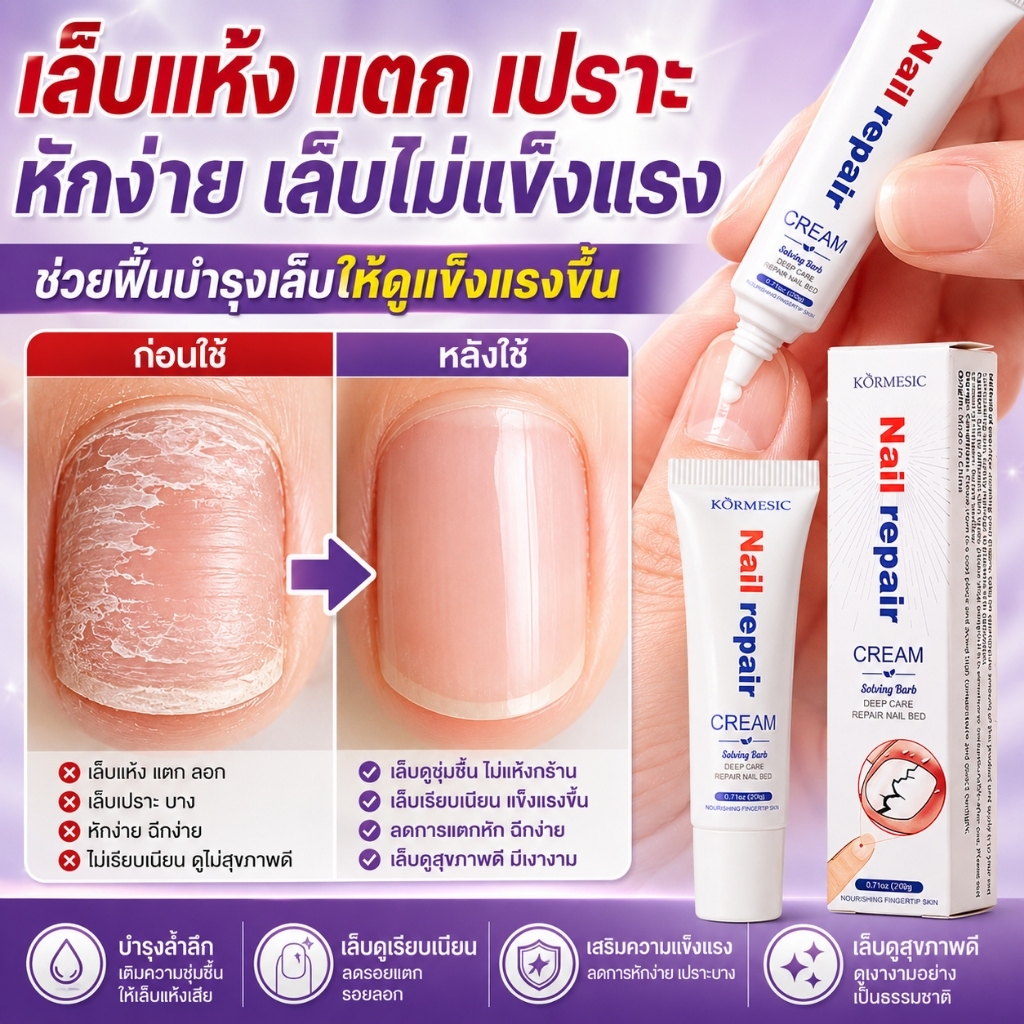 ยาทาเชื้อราที่เล็บ ช่วยดูแลปัญหาเชื้อราที่เล็บ บำรุงและฟื้นฟูเล็บที่เสียหาย สูตรอ่อนโยน ไม่เหนียวเหนอะหนะ พกพาสะดวก 20g