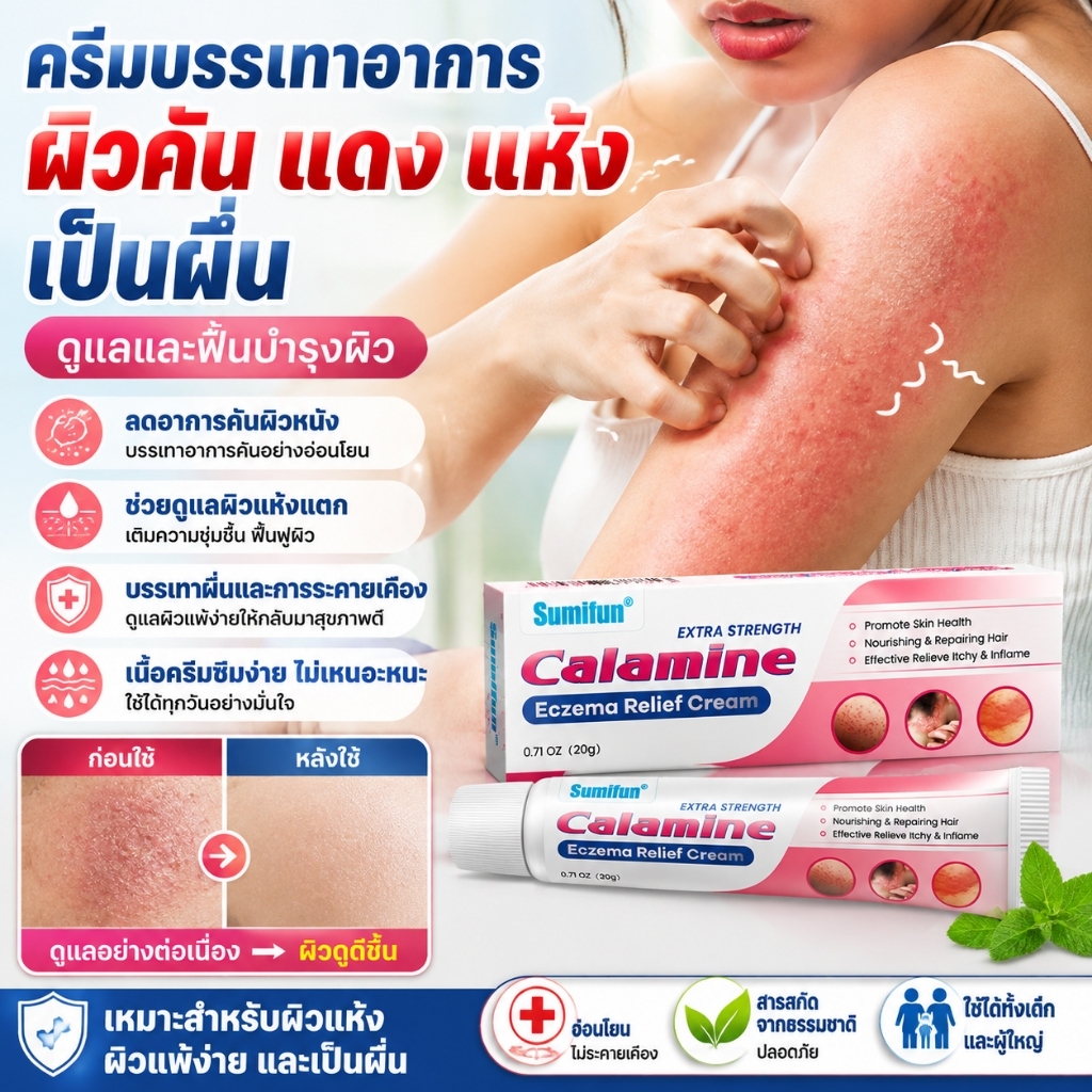 การฟื้นฟูอย่างมืออาชีพ ทาแก้เชื้อรา โรคผิวหนัง เกลื้อน กลาก คัน สมุนไพร แก้คันเรื้อรัง คันในร่มผ้า คันในร่มผ้า ครีมแก้ค